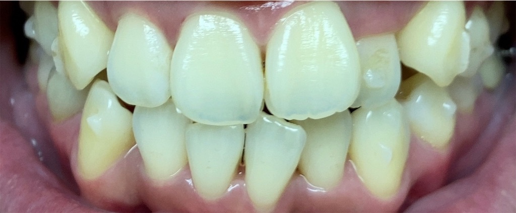 f:id:fmdesign:20200617093953j:image f:id:fmdesign:20200617093953j:image