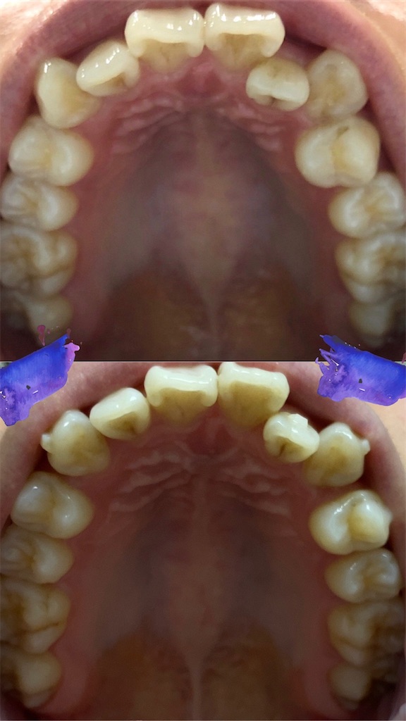 f:id:fmdesign:20200617094039j:image f:id:fmdesign:20200617094039j:image