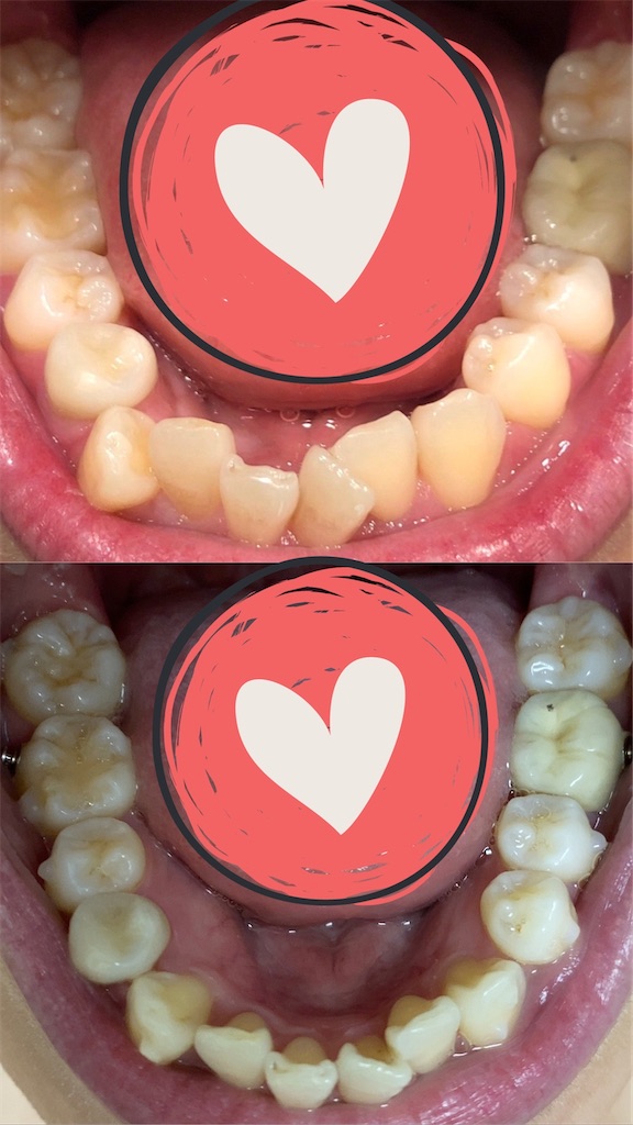 f:id:fmdesign:20200617094117j:image f:id:fmdesign:20200617094117j:image