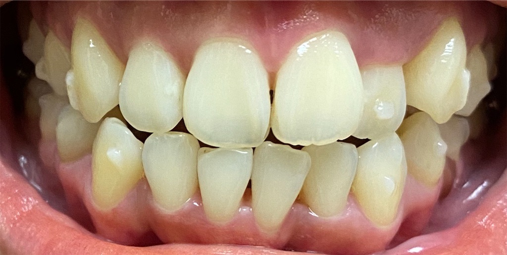 f:id:fmdesign:20200804202924j:image f:id:fmdesign:20200804202924j:image