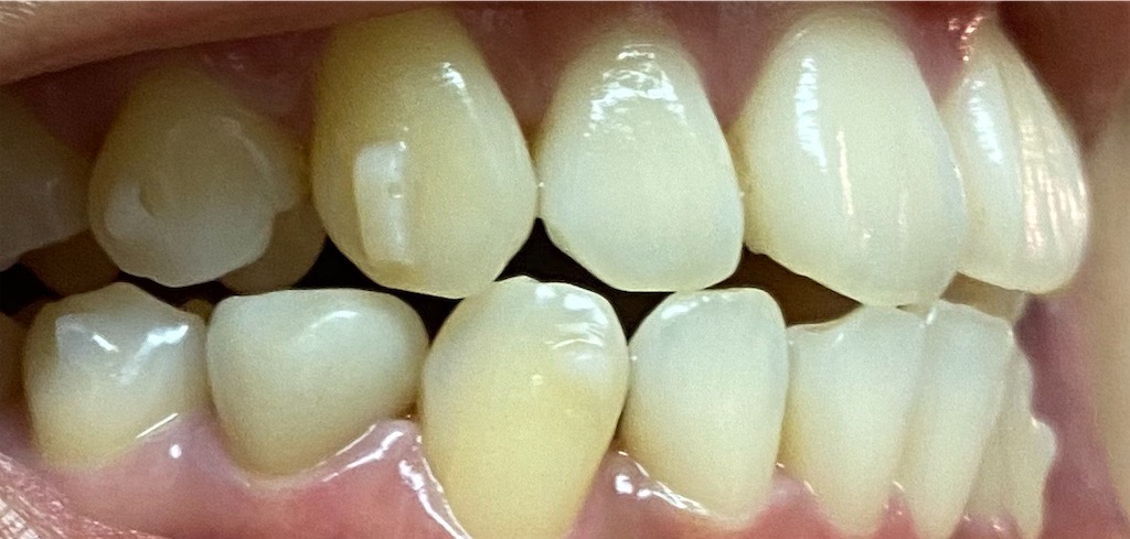 f:id:fmdesign:20200804203037j:image f:id:fmdesign:20200804203037j:image