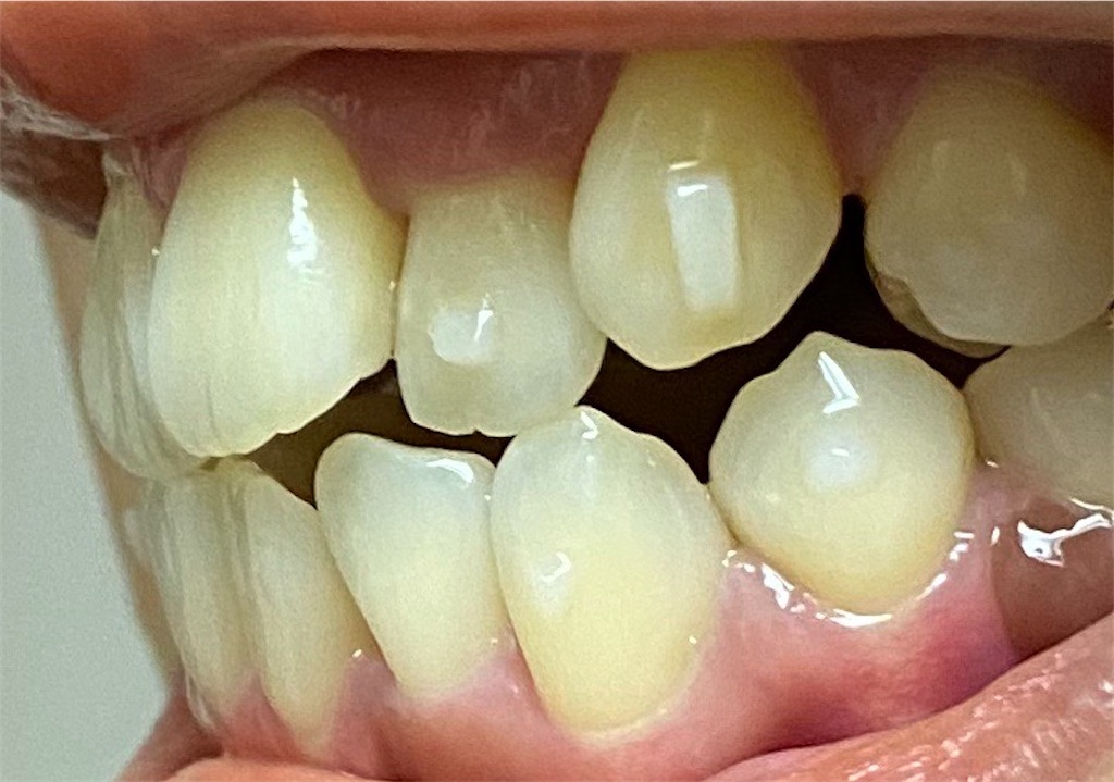 f:id:fmdesign:20200804203326j:image f:id:fmdesign:20200804203326j:image