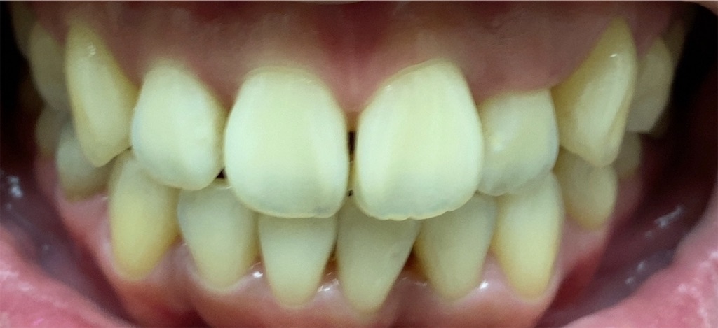 f:id:fmdesign:20201019182117j:image f:id:fmdesign:20201019182117j:image