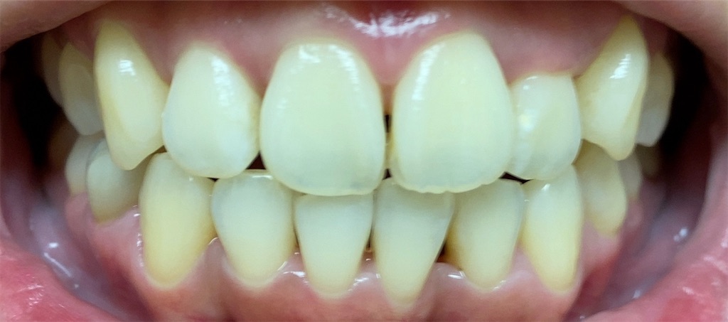 f:id:fmdesign:20201019182137j:image f:id:fmdesign:20201019182137j:image