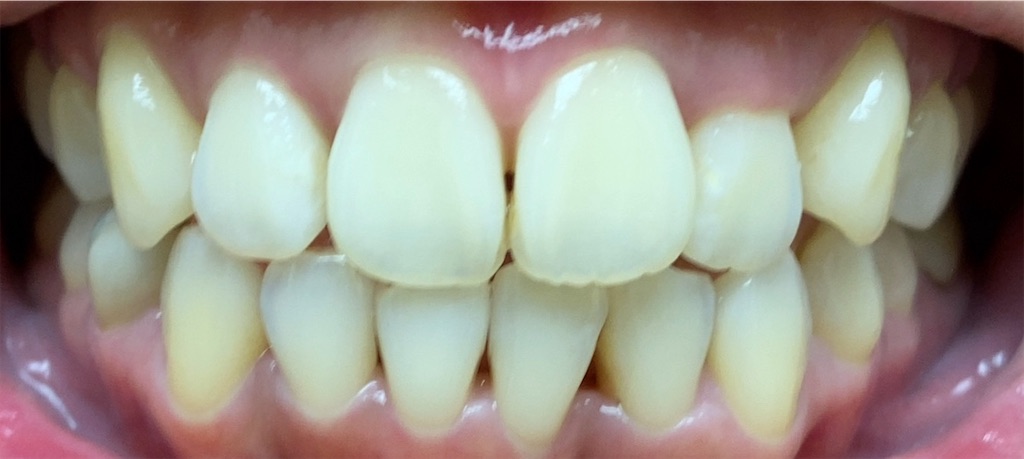 f:id:fmdesign:20201019214915j:image f:id:fmdesign:20201019214915j:image