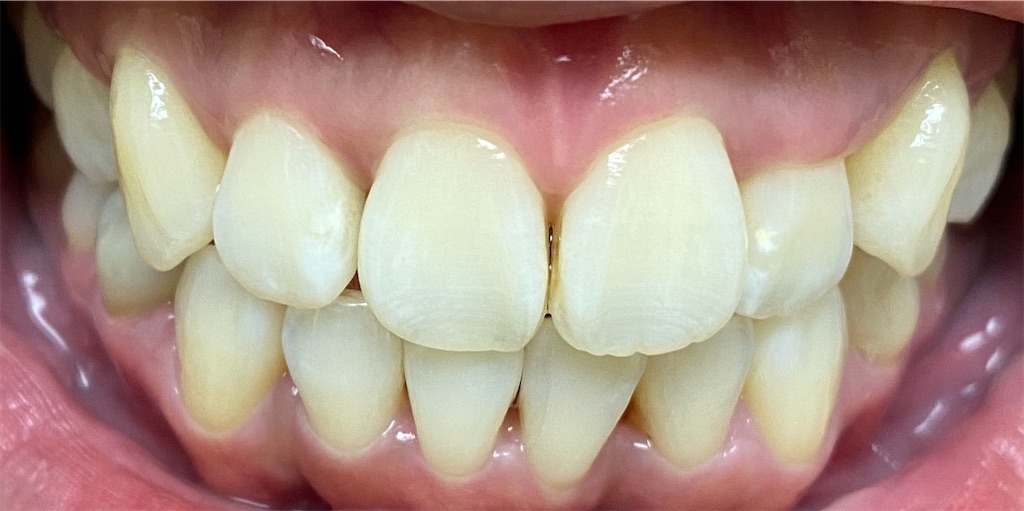 f:id:fmdesign:20201022151934j:image f:id:fmdesign:20201022151934j:image