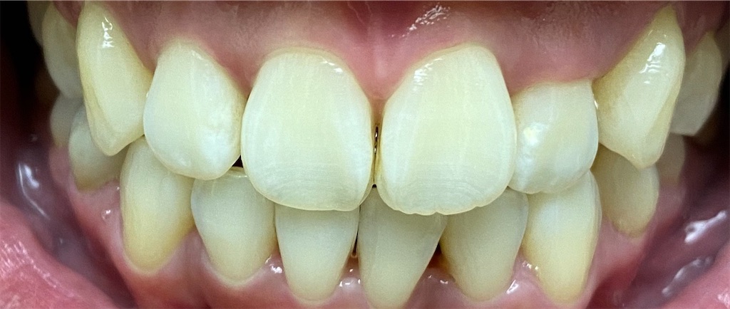 f:id:fmdesign:20201025204820j:image f:id:fmdesign:20201025204820j:image