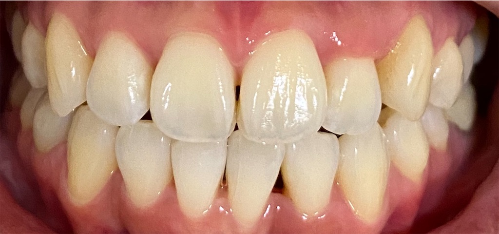 f:id:fmdesign:20201027211817j:image f:id:fmdesign:20201027211817j:image