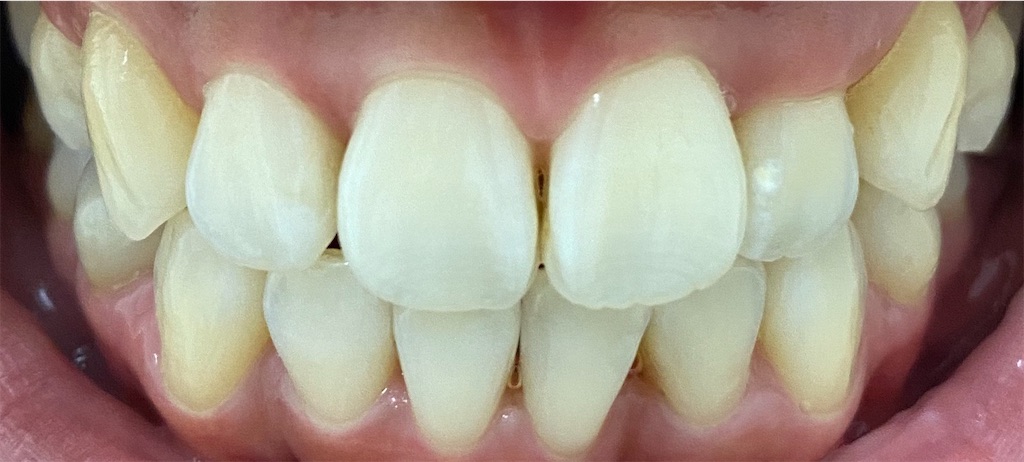 f:id:fmdesign:20201101134831j:image f:id:fmdesign:20201101134831j:image