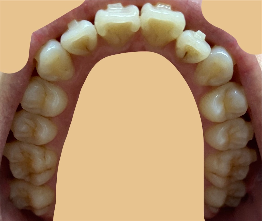 f:id:fmdesign:20201105225229j:image f:id:fmdesign:20201105225229j:image