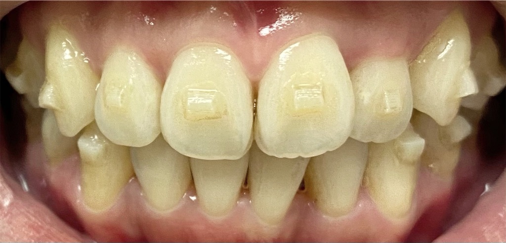 f:id:fmdesign:20210203122307j:image f:id:fmdesign:20210203122307j:image