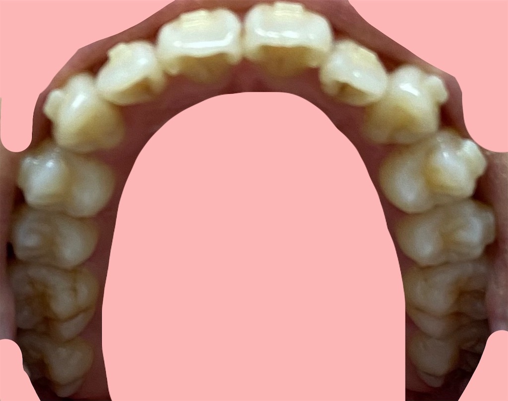 f:id:fmdesign:20210203122808j:image f:id:fmdesign:20210203122808j:image