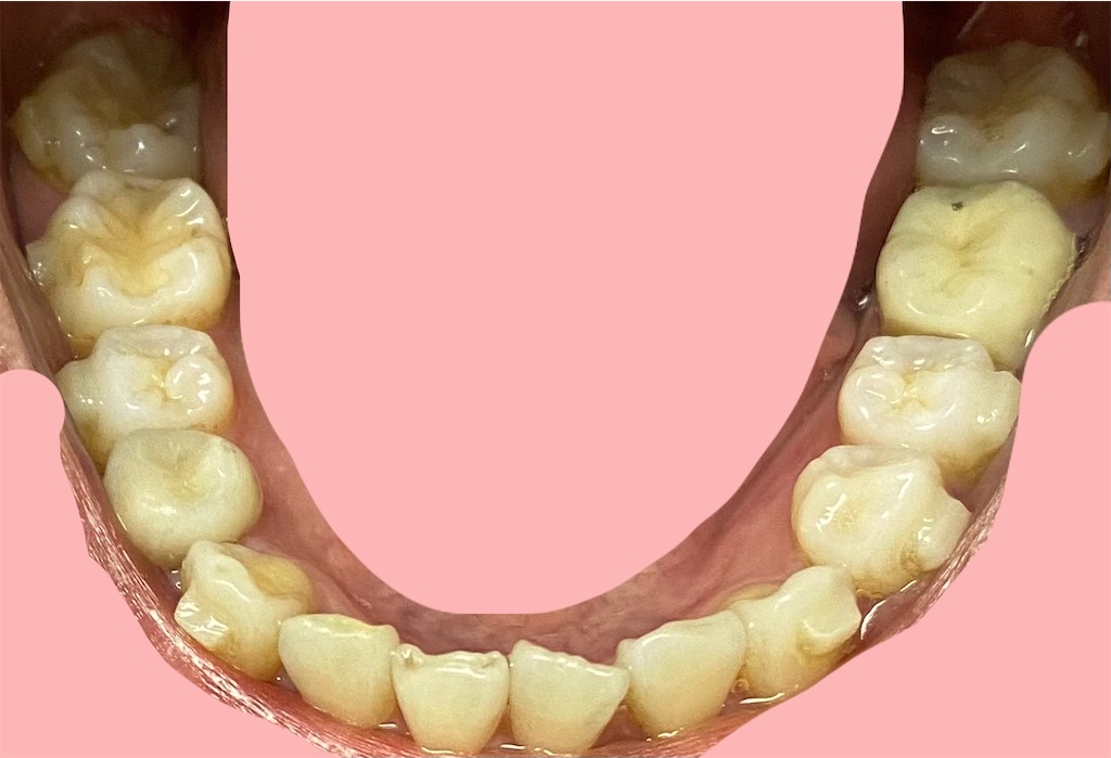 f:id:fmdesign:20210203122814j:image f:id:fmdesign:20210203122814j:image