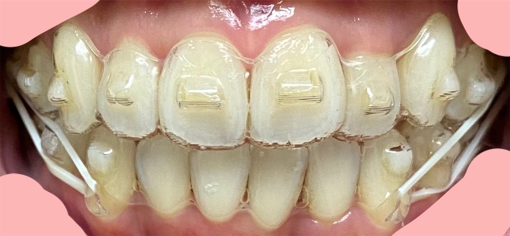 f:id:fmdesign:20210203122909j:image f:id:fmdesign:20210203122909j:image