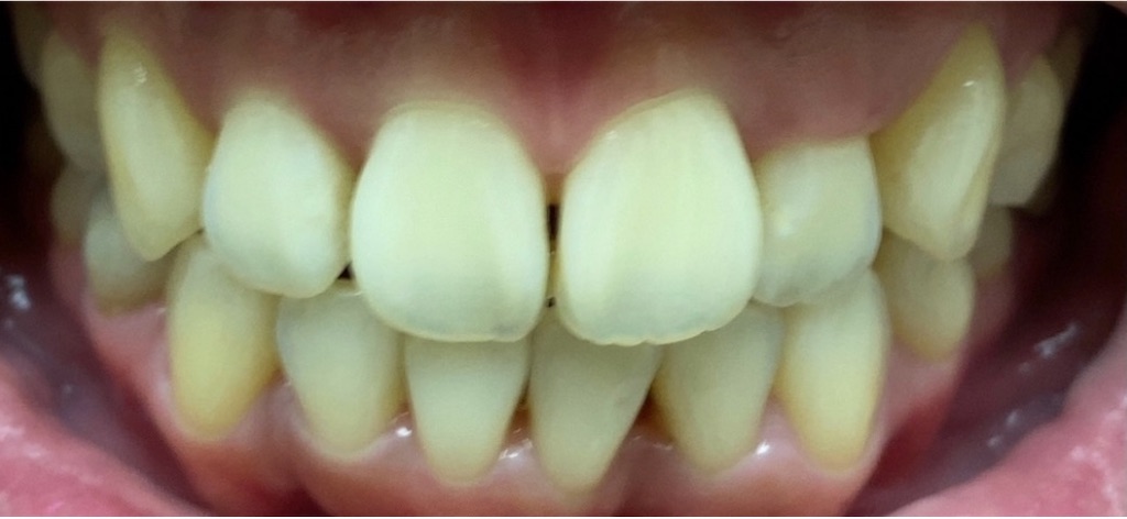 f:id:fmdesign:20210204090959j:image f:id:fmdesign:20210204090959j:image