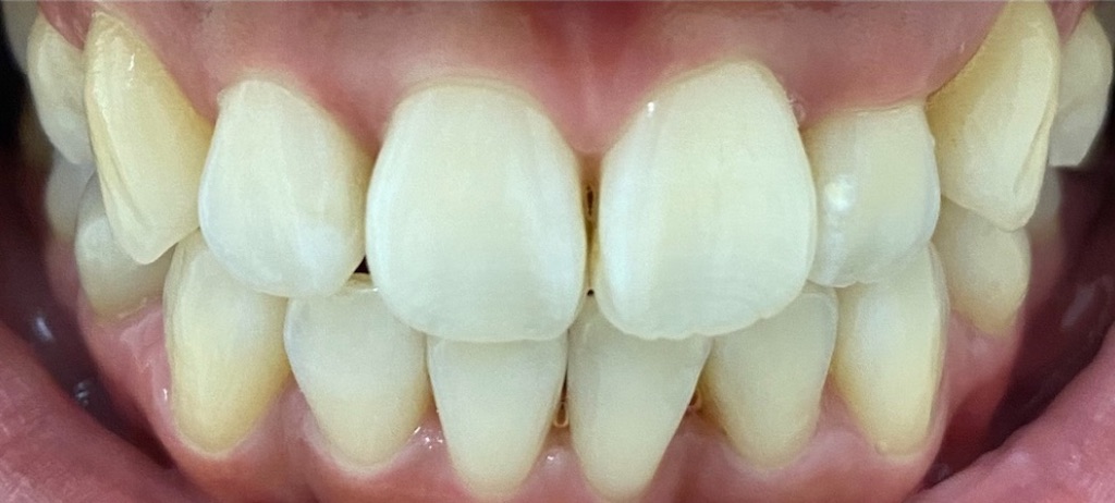 f:id:fmdesign:20210204091002j:image f:id:fmdesign:20210204091002j:image