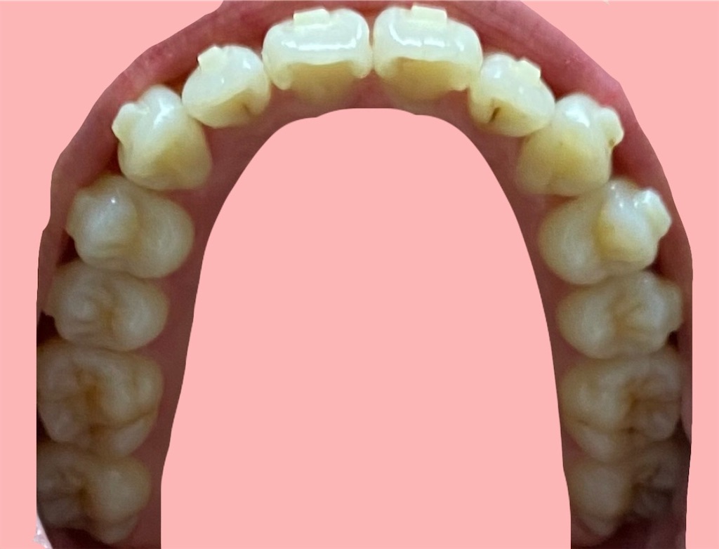 f:id:fmdesign:20210513182322j:image f:id:fmdesign:20210513182322j:image