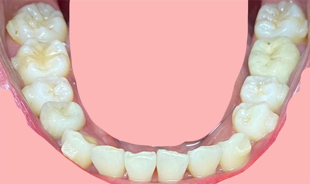 f:id:fmdesign:20210513182327j:image f:id:fmdesign:20210513182327j:image