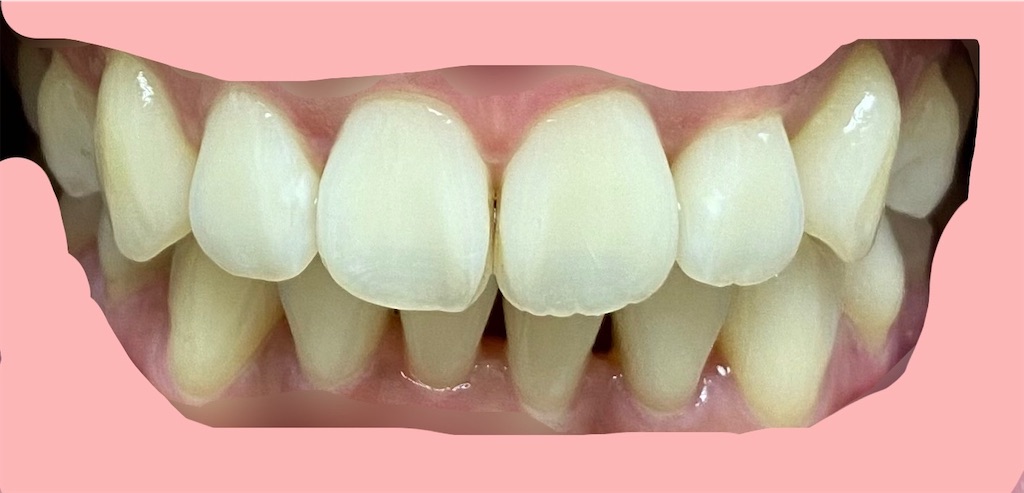 f:id:fmdesign:20210819202859j:image f:id:fmdesign:20210819202859j:image