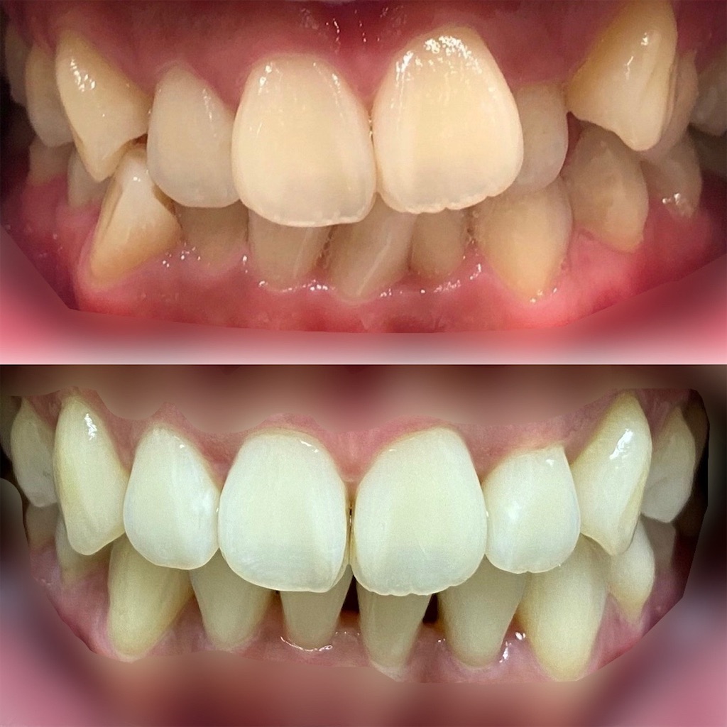 f:id:fmdesign:20210819202956j:image f:id:fmdesign:20210819202956j:image