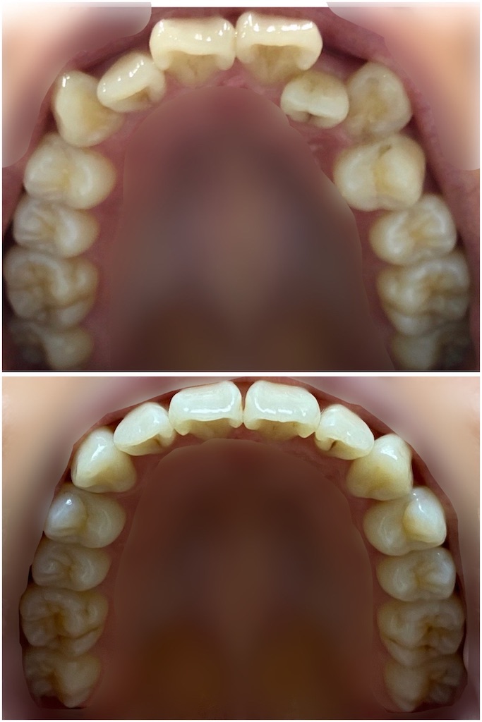 f:id:fmdesign:20210819203002j:image f:id:fmdesign:20210819203002j:image