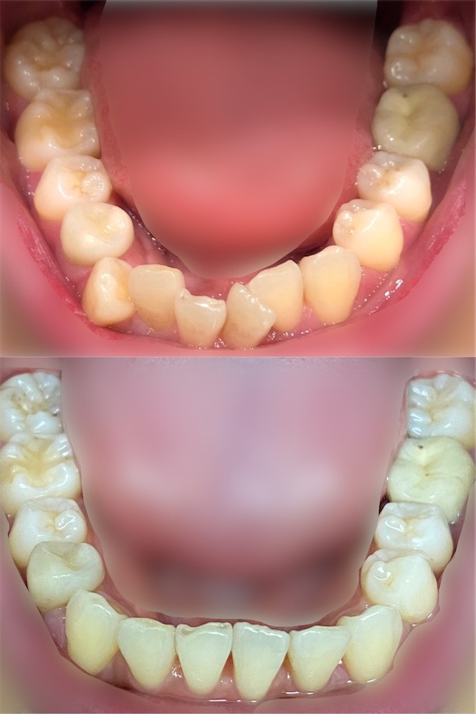 f:id:fmdesign:20210819203021j:image f:id:fmdesign:20210819203021j:image