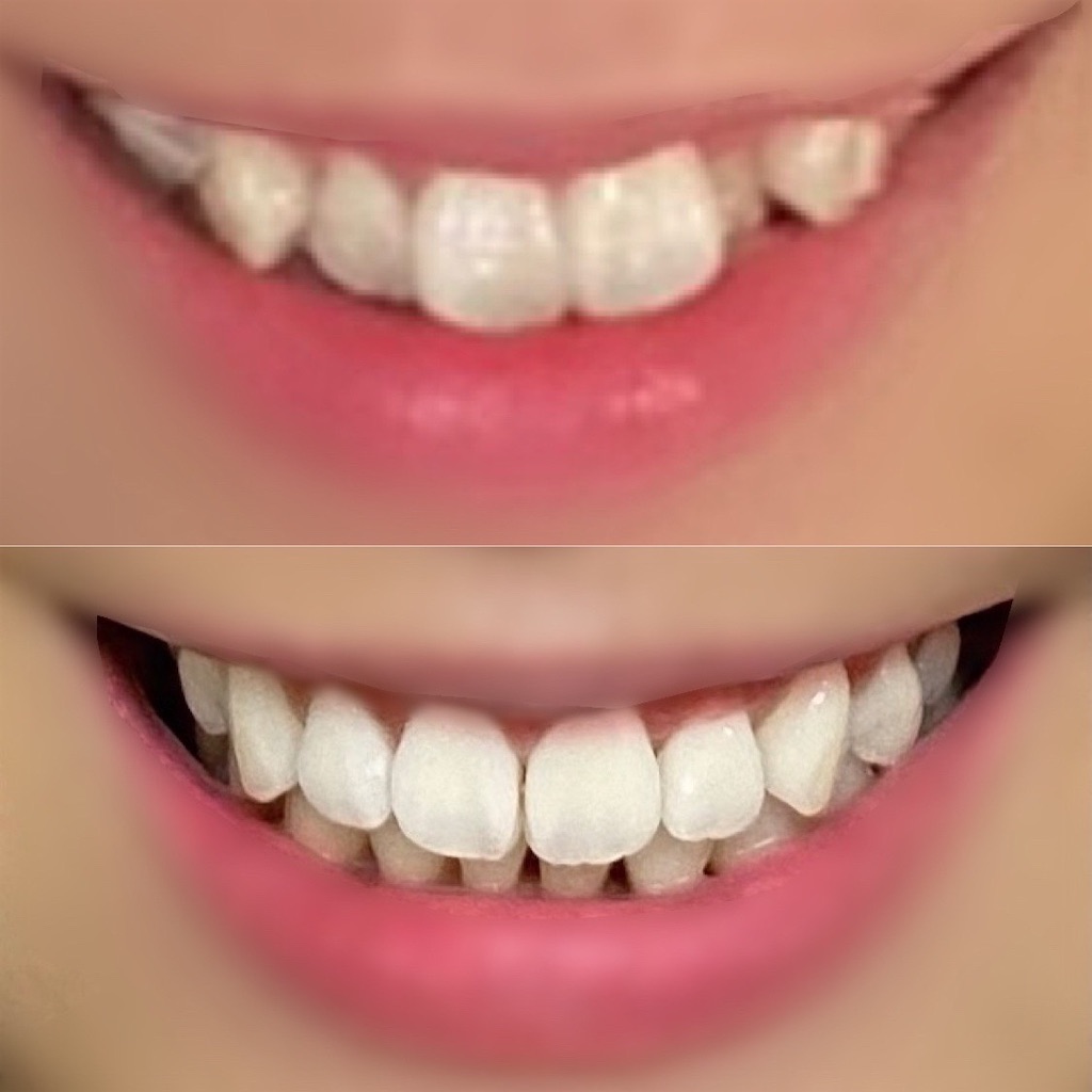 f:id:fmdesign:20210819203103j:image f:id:fmdesign:20210819203103j:image