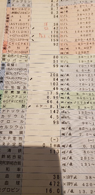 f:id:fopyokoyama:20210417162702j:image
