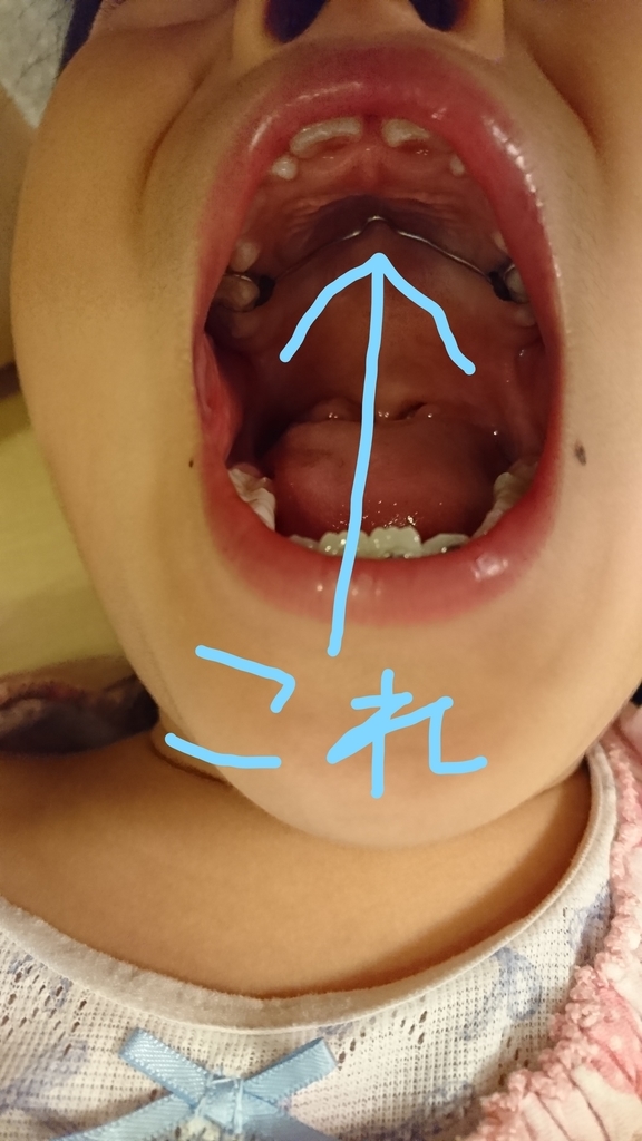 f:id:for-mom:20181005221102j:plain