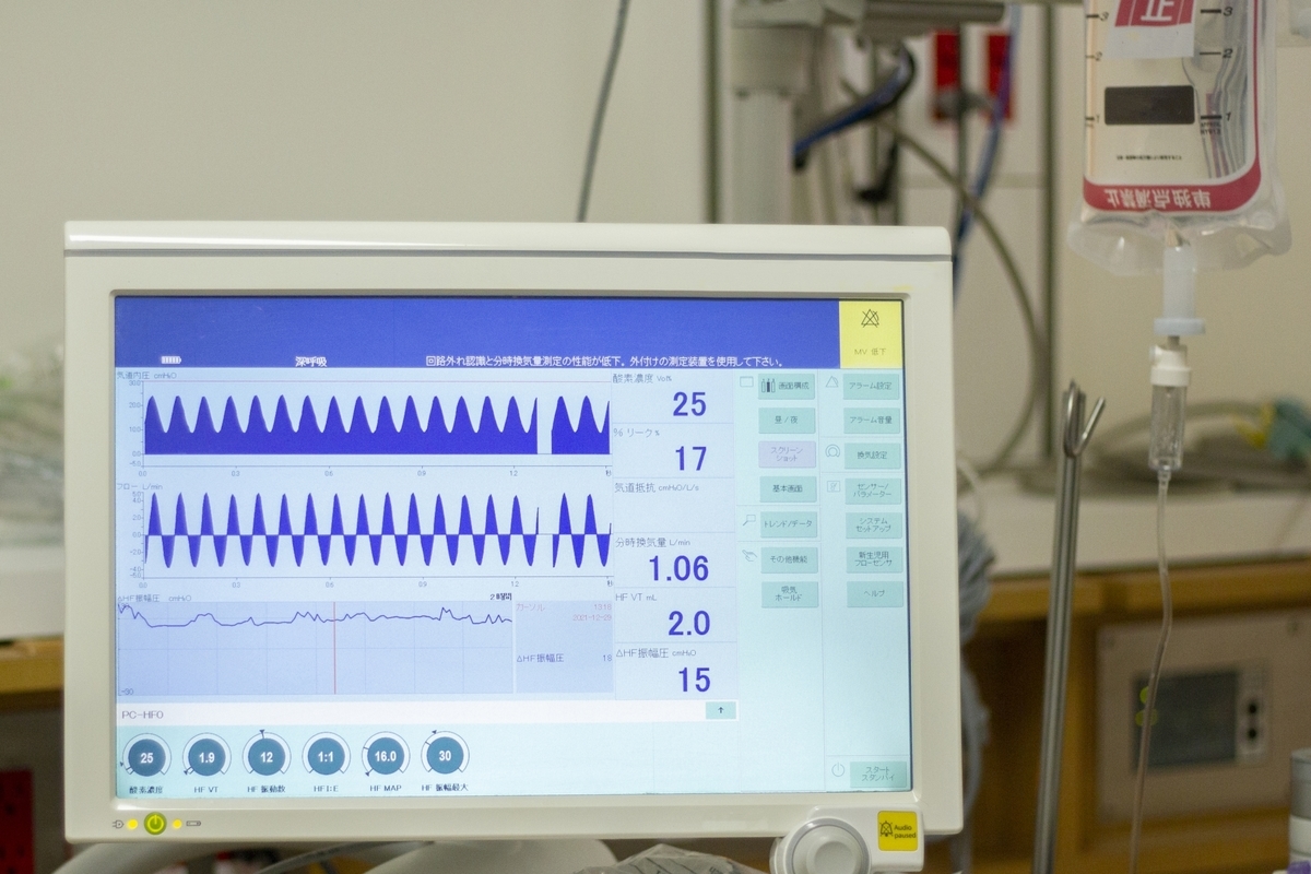 医療機器のモニター