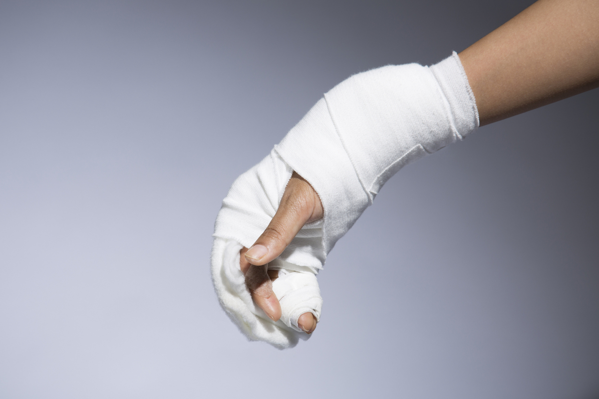 骨折した手