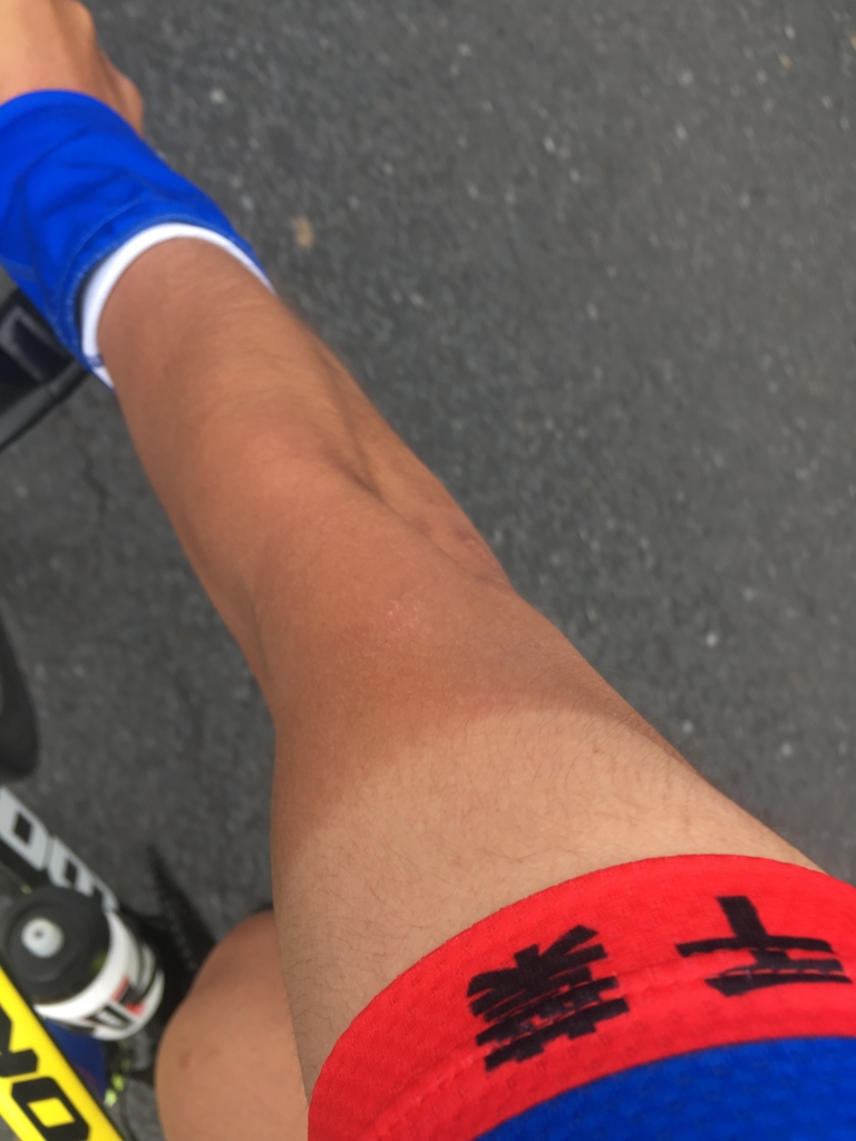 f:id:freedomtencho:20170507155151j:plain f:id:freedomtencho:20170507155151j:plain