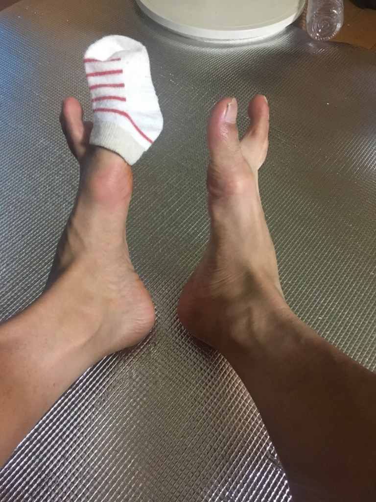 f:id:freedomtencho:20171008010233j:plain