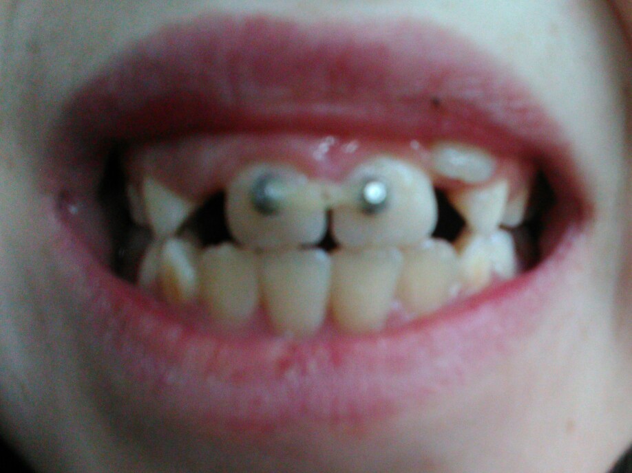 f:id:freemyself:20220201164828j:plain