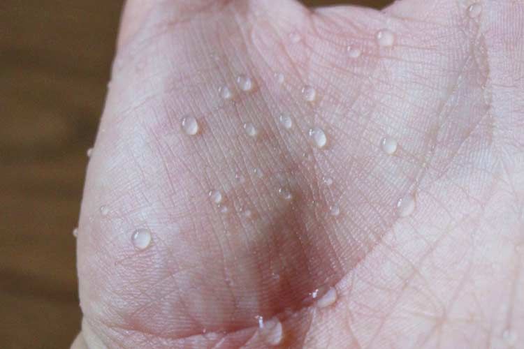 NIKWAXコットンプルーフで撥水加工されてしまった手の皮膚