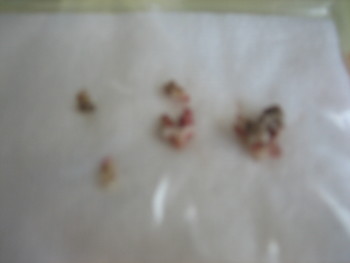 f:id:fukuyuzu:20120709204541j:image