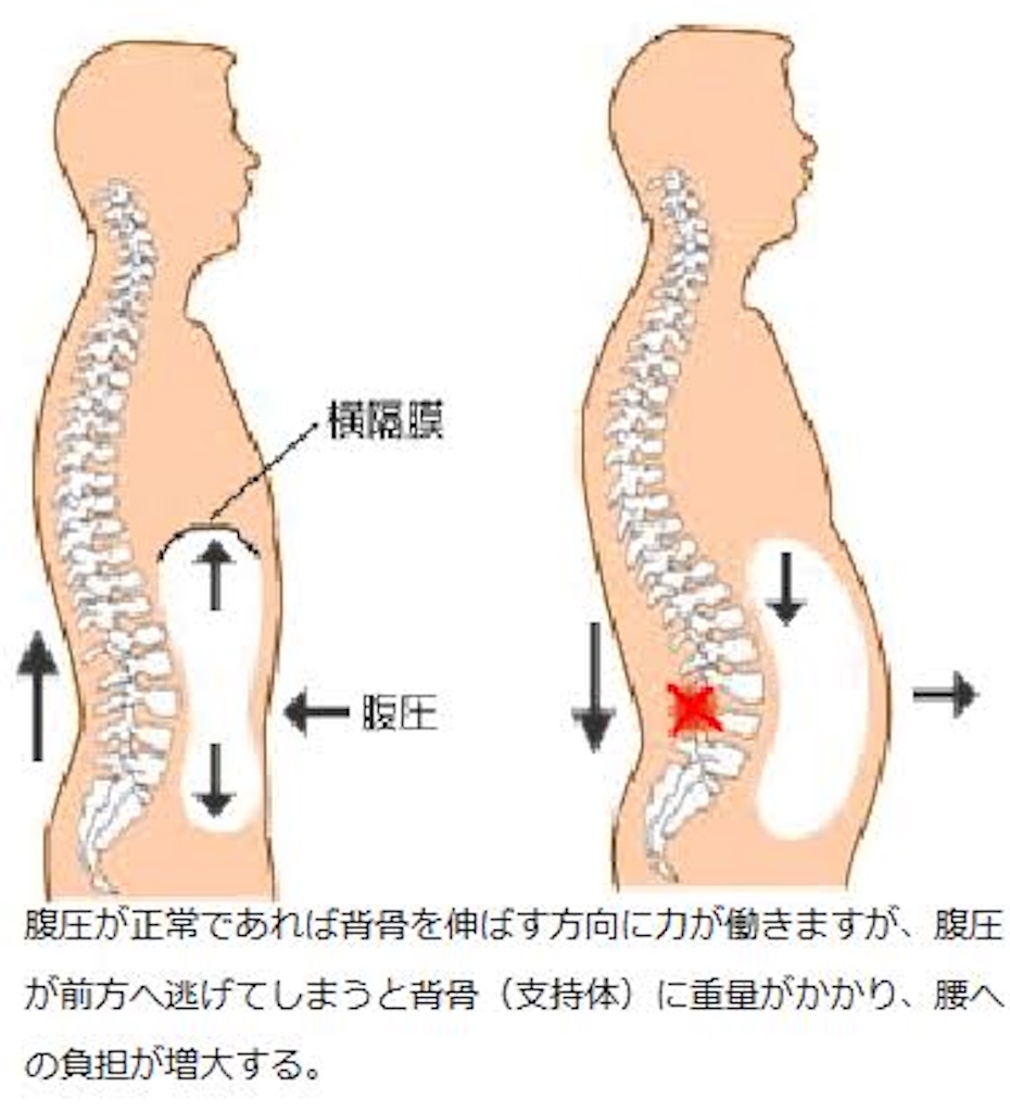 f:id:fumi23787256:20200717202701j:image f:id:fumi23787256:20200717202701j:image