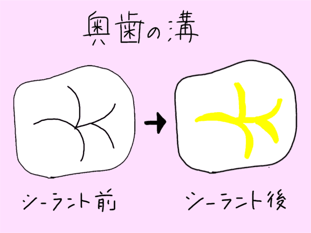 f:id:fumitotama:20200830142145p:image