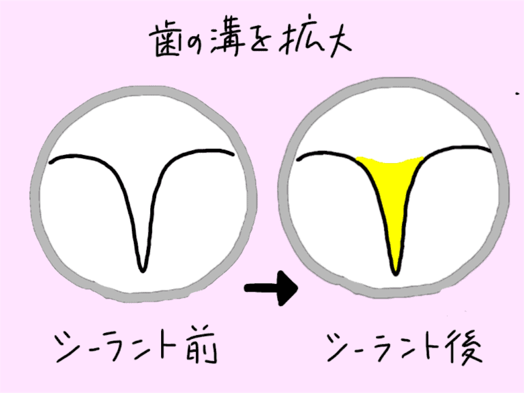 f:id:fumitotama:20200830142150p:image