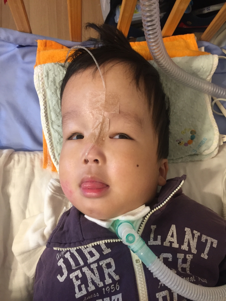 f:id:fz4001979:20170219221915j:plain f:id:fz4001979:20170219221915j:plain