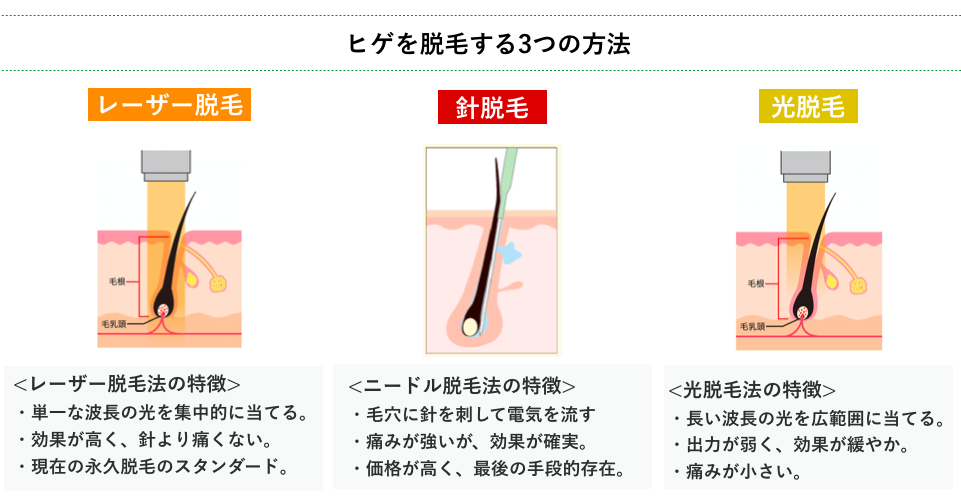 f:id:g-yuta0323:20180429084816p:plain