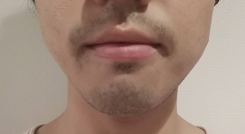 f:id:g041j040:20181202133311j:plain f:id:g041j040:20181202133311j:plain