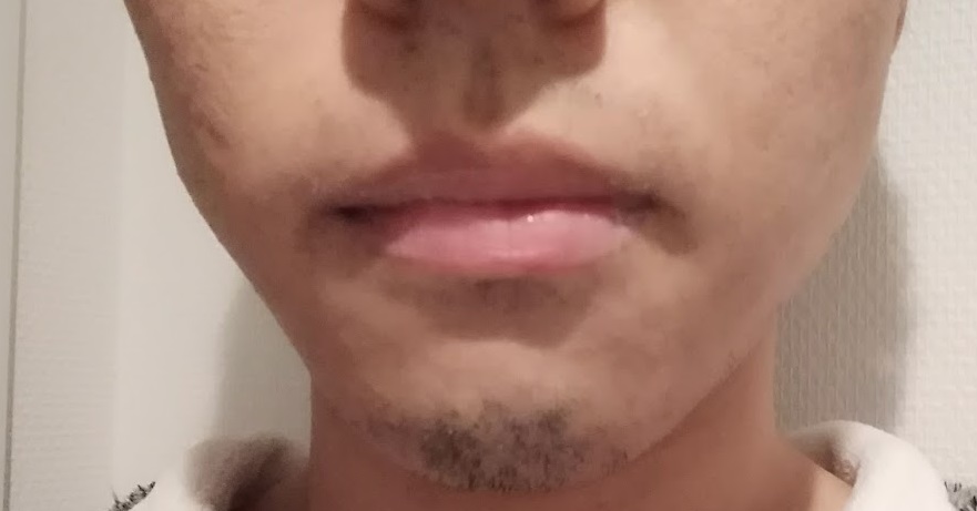 f:id:g041j040:20181210205322j:plain f:id:g041j040:20181210205322j:plain