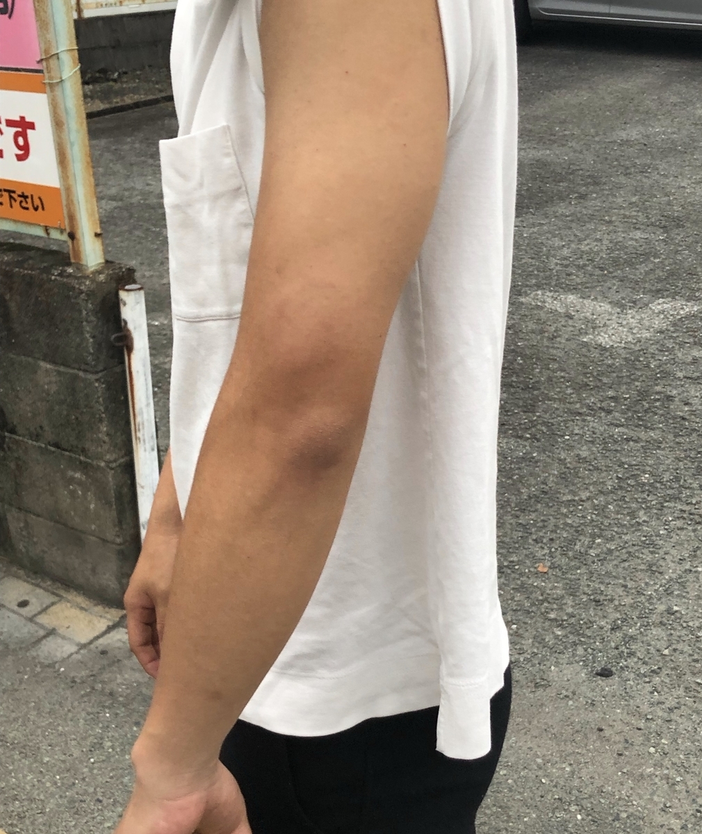 f:id:gachapi--n:20200619220950j:plain