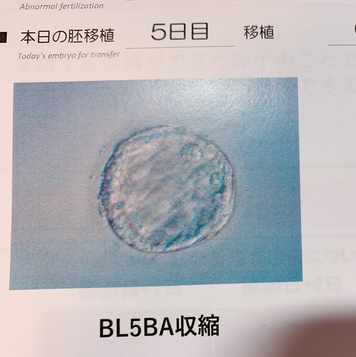 胚盤胞移植BL5BA