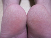 f:id:ganaware:20100513221450j:image f:id:ganaware:20100513221450j:image