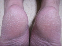 f:id:ganaware:20100515231311j:image f:id:ganaware:20100515231311j:image