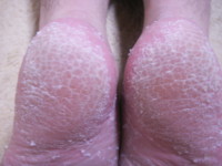 f:id:ganaware:20100523181019j:image f:id:ganaware:20100523181019j:image