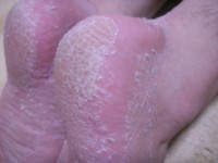 f:id:ganaware:20100523181045j:image f:id:ganaware:20100523181045j:image