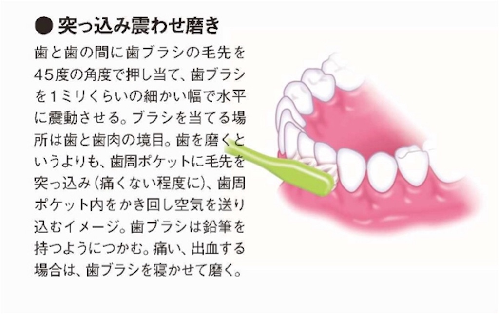 f:id:garage-kid:20190306202141j:plain